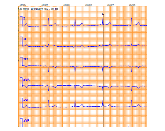 ECG Register Report - PARC Cardio Screening Device - PARC Diagnostics LTD